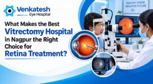 What Makes the Best Vitrectomy Hospital in Nagpur the Right Choice for Retina Treatment?